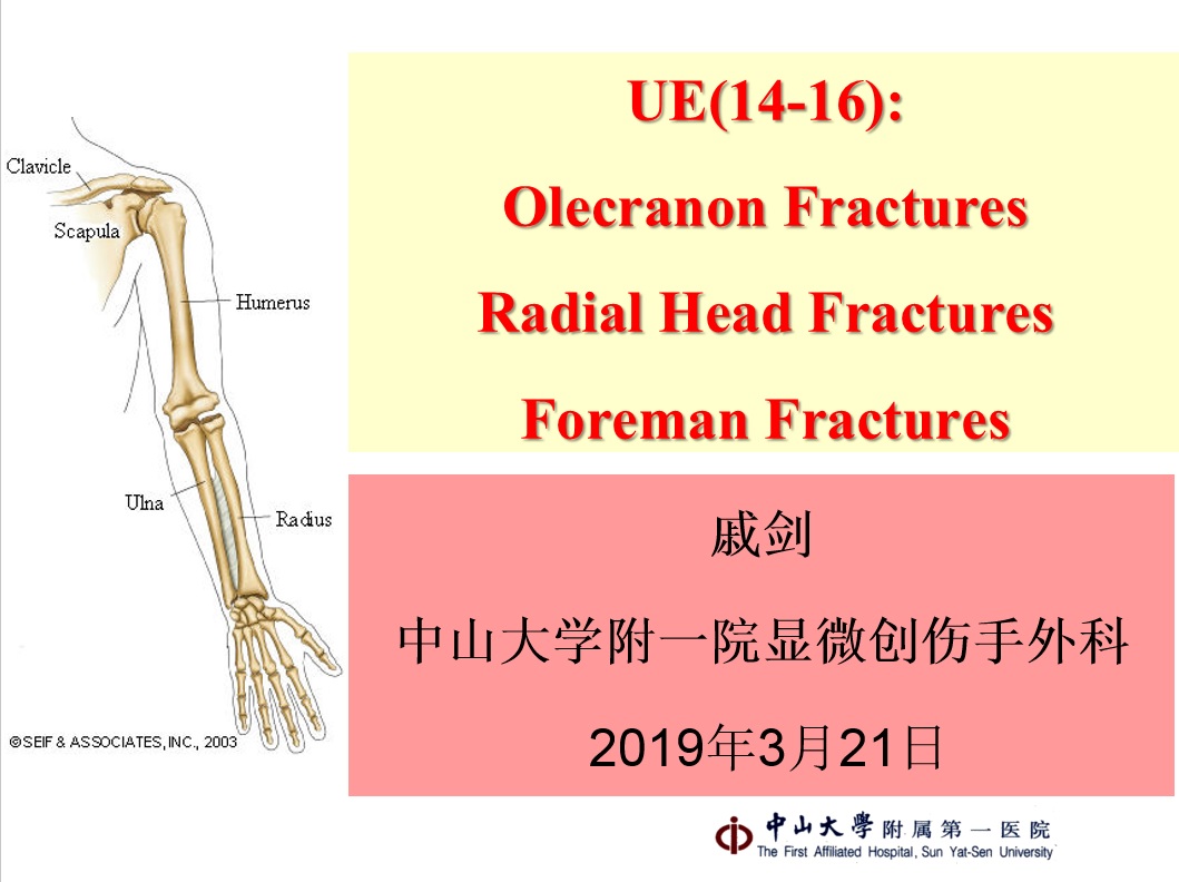 Olecranon Fractures Radia